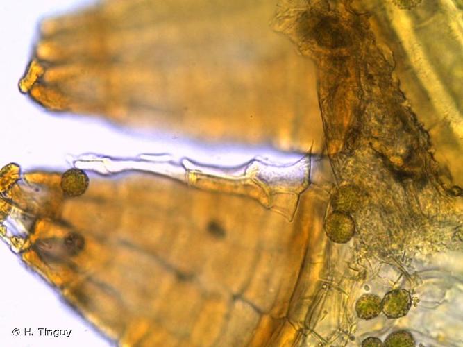 <i>Orthotrichum schimperi</i> Hammar, 1852 © H. Tinguy