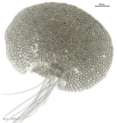 <i>Solenostoma confertissimum</i> (Nees) Schljakov, 1981 © H. TINGUY