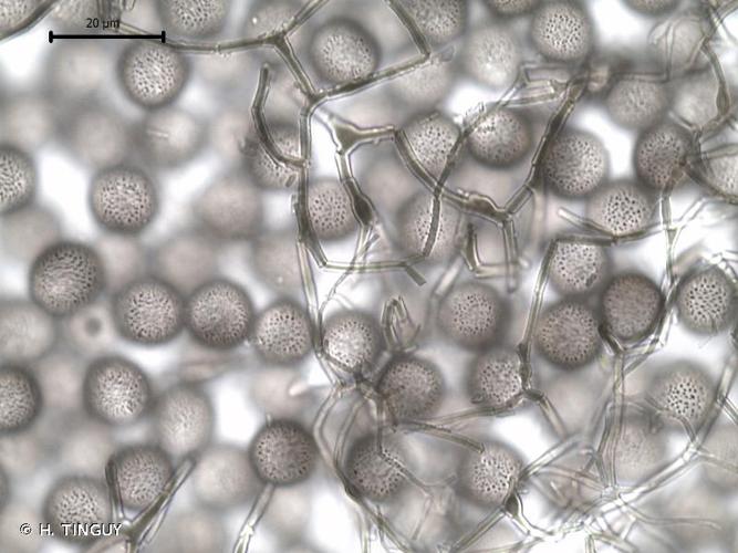 <i>Colloderma oculatum</i> (C.Lippert) G.Lister, 1910 © H. TINGUY